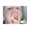 Kit Throat Scope® Abbassalingua Luminosi - 1 Kit - immagine 2