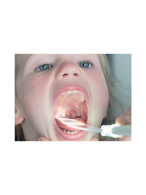 Kit Throat Scope® Abbassalingua Luminosi - 1 Kit - immagine 2