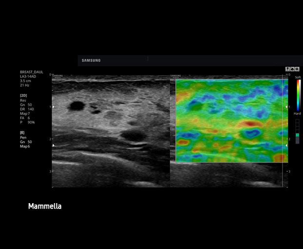 elastoscan