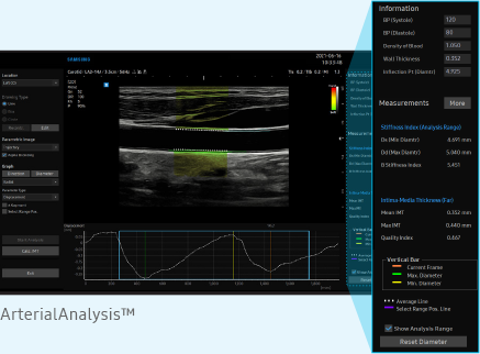 arterial analysis