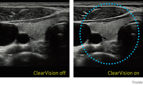 clear vision hs40