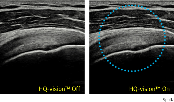 hq vision hs40