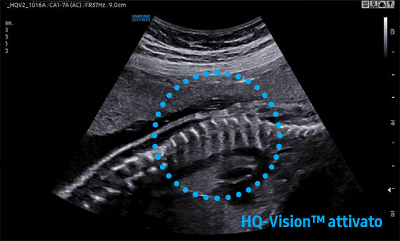 hq vision attivo