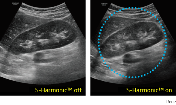 s harmonic hs40